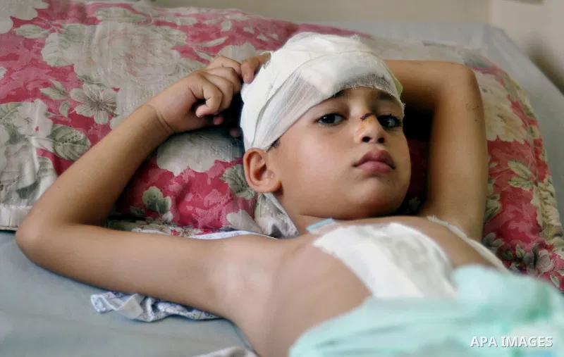 Palestinian Children rests at the Shifa hospital to receiving treatment, in Gaza City, on August 2, 2014. The Israeli army gave a first indication it was ending operations in parts of Gaza, while continuing to bombard ot...