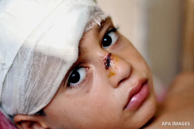 Palestinian Children rests at the Shifa hospital to receiving treatment, in Gaza City, on August 2, 2014. The Israeli army gave a first indication it was ending operations in parts of Gaza, while continuing to bombard ot...