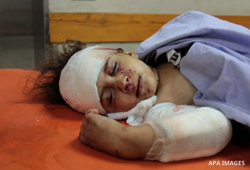 A Palestinian Child rests at the Shifa hospital to receiving treatment, in Gaza City, on August 2, 2014. The Israeli army gave a first indication it was ending operations in parts of Gaza, while continuing to bombard oth...
