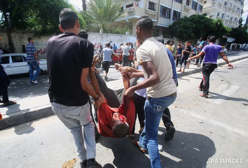 A wounded man at a United Nations run school after Israeli air strikes in Rafah in the southern Gaza Strip on, 03 August 2014. At least 10 people were killed in an airstrike on 03 August 2014 on a United Nations school s...