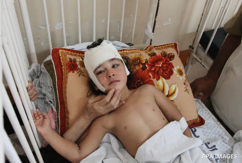 In this Sunday, August 03, 2014 photo, Palestinian children, rests at the Shifa hospital where they are receiving treatment for Injuries caused by Israeli shelling on neighborhoods in Gaza City .Photo by Ezz al-Zanoun