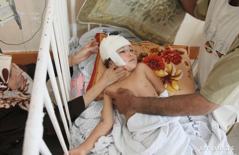 In this Sunday, August 03, 2014 photo, Palestinian children, rests at the Shifa hospital where they are receiving treatment for Injuries caused by Israeli shelling on neighborhoods in Gaza City .Photo by Ezz al-Zanoun