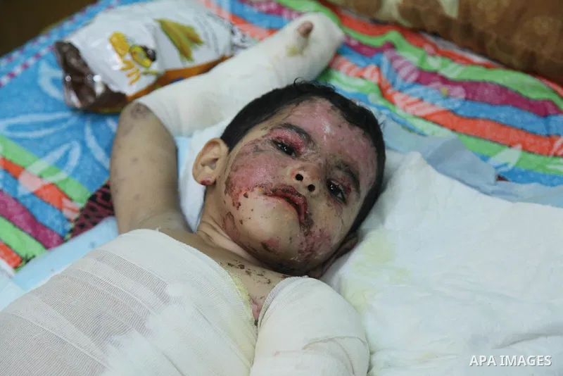 In this Sunday, August 03, 2014 photo, Palestinian children, rests at the Shifa hospital where they are receiving treatment for Injuries caused by Israeli shelling on neighborhoods in Gaza City .Photo by Ezz al-Zanoun