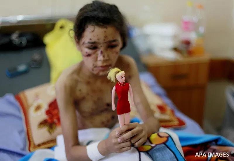 In this Sunday, August 03, 2014 photo, Palestinian children, rests at the Shifa hospital where they are receiving treatment for Injuries caused by Israeli shelling on neighborhoods in Gaza City .Photo by Ezz al-Zanoun