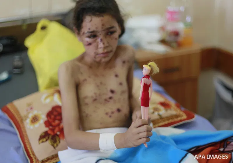 In this Sunday, August 03, 2014 photo, Palestinian children, rests at the Shifa hospital where they are receiving treatment for Injuries caused by Israeli shelling on neighborhoods in Gaza City .Photo by Ezz al-Zanoun