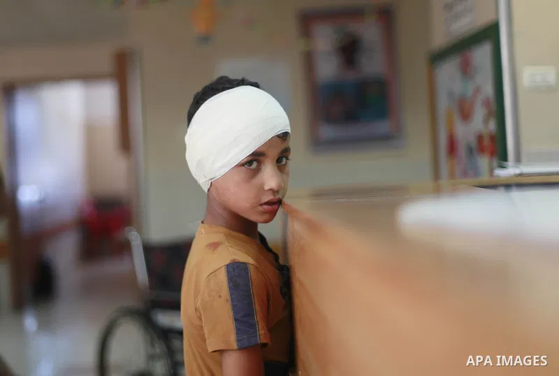 In this Sunday, August 03, 2014 photo, Palestinian children, rests at the Shifa hospital where they are receiving treatment for Injuries caused by Israeli shelling on neighborhoods in Gaza City .Photo by Ezz al-Zanoun