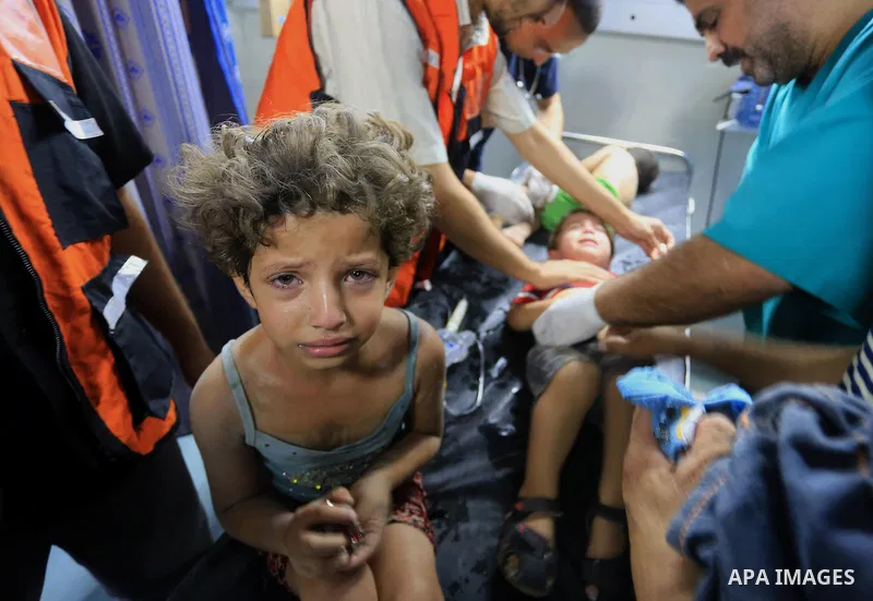 Palestinian childern, wounded in an Israeli air strike on the al-Shati refugee camp, lie on the a stretcher as they are treated at the al-Shefa hospital in Gaza City, on August 4, 2014. An eight-year-old girl was killed...