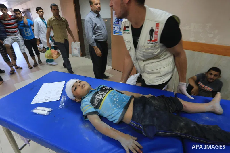A Palestinian boy, wounded in an Israeli air strike on the al-Shati refugee camp, lies on a stretcher as he is treated at the al-Shefa hospital in Gaza City, on August 4, 2014. An eight-year-old girl was killed and 30 pe...