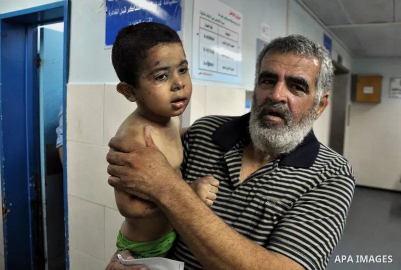 A Palestinian boy, wounded in an Israeli air strike on the al-Shati refugee camp, at the al-Shefa hospital in Gaza City, on August 4, 2014. An eight-year-old girl was killed and 30 people wounded in a strike on the beach...