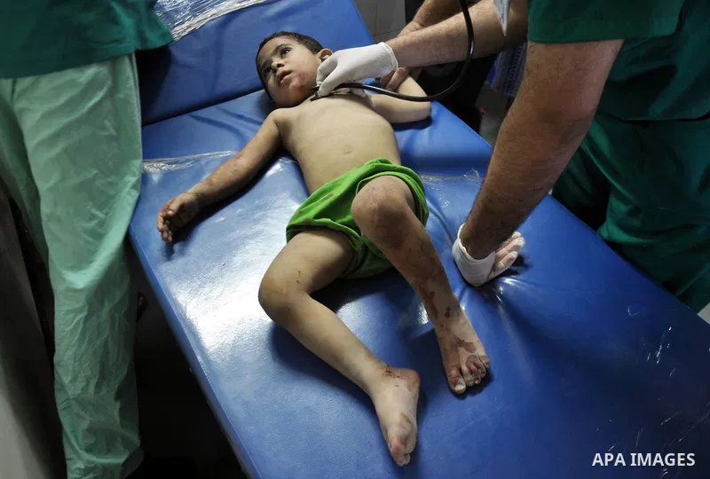 A Palestinian boy, wounded in an Israeli air strike on the al-Shati refugee camp, lies on a stretcher as he is treated at the al-Shefa hospital in Gaza City, on August 4, 2014. An eight-year-old girl was killed and 30 pe...