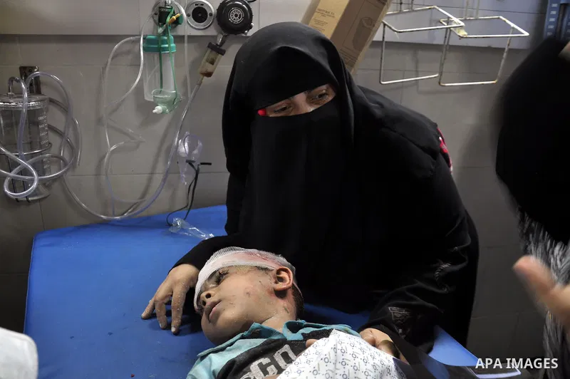A Palestinian boy, wounded in an Israeli air strike on the al-Shati refugee camp, lies on a stretcher as he is treated at the al-Shefa hospital in Gaza City, on August 4, 2014. An eight-year-old girl was killed and 30 pe...