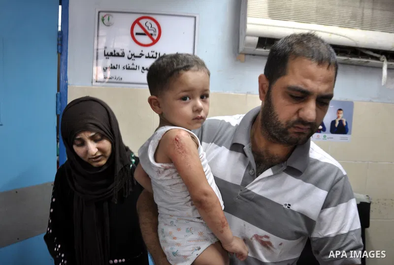 A Palestinian boy, wounded in an Israeli air strike on the al-Shati refugee camp, at the al-Shefa hospital in Gaza City, on August 4, 2014. An eight-year-old girl was killed and 30 people wounded in a strike on the beach...