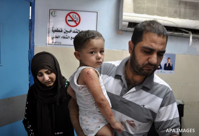A Palestinian boy, wounded in an Israeli air strike on the al-Shati refugee camp, at the al-Shefa hospital in Gaza City, on August 4, 2014. An eight-year-old girl was killed and 30 people wounded in a strike on the beach...