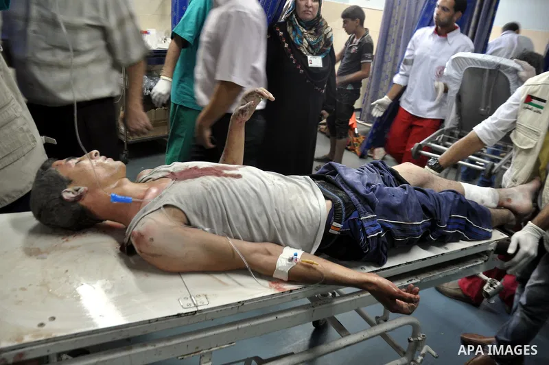 A Palestinian boy, wounded in an Israeli air strike on the al-Shati refugee camp, lies on a stretcher as he is treated at the al-Shefa hospital in Gaza City, on August 4, 2014. An eight-year-old girl was killed and 30 pe...