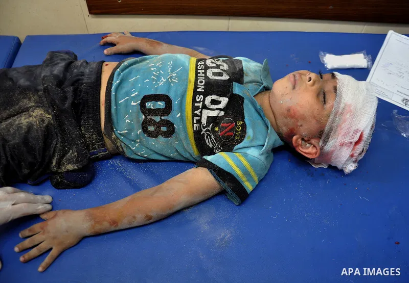 A Palestinian boy, wounded in an Israeli air strike on the al-Shati refugee camp, lies on a stretcher as he is treated at the al-Shefa hospital in Gaza City, on August 4, 2014. An eight-year-old girl was killed and 30 pe...