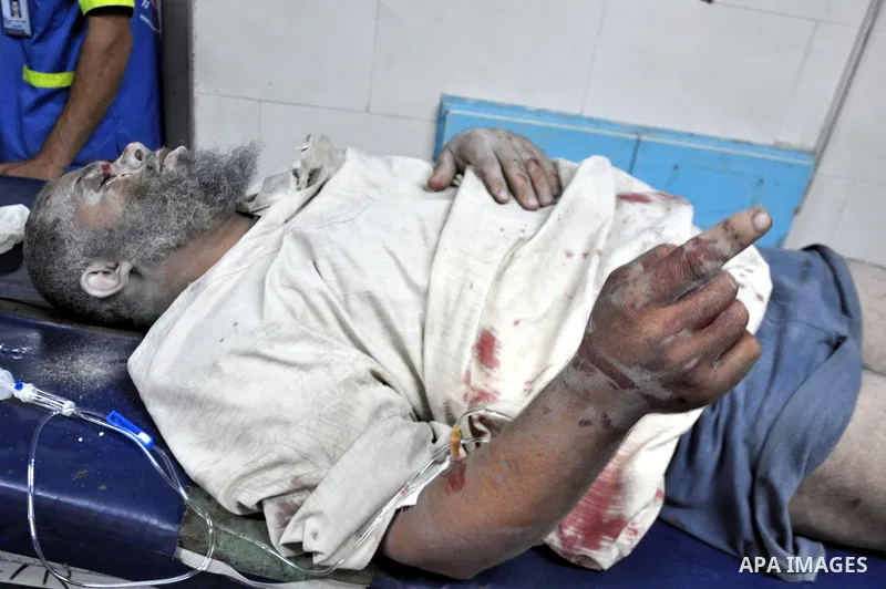 A Palestinian man, wounded in an Israeli air strike on the al-Shati refugee camp, lies on a stretcher as he is treated at the al-Shefa hospital in Gaza City, on August 4, 2014. An eight-year-old girl was killed and 30 pe...