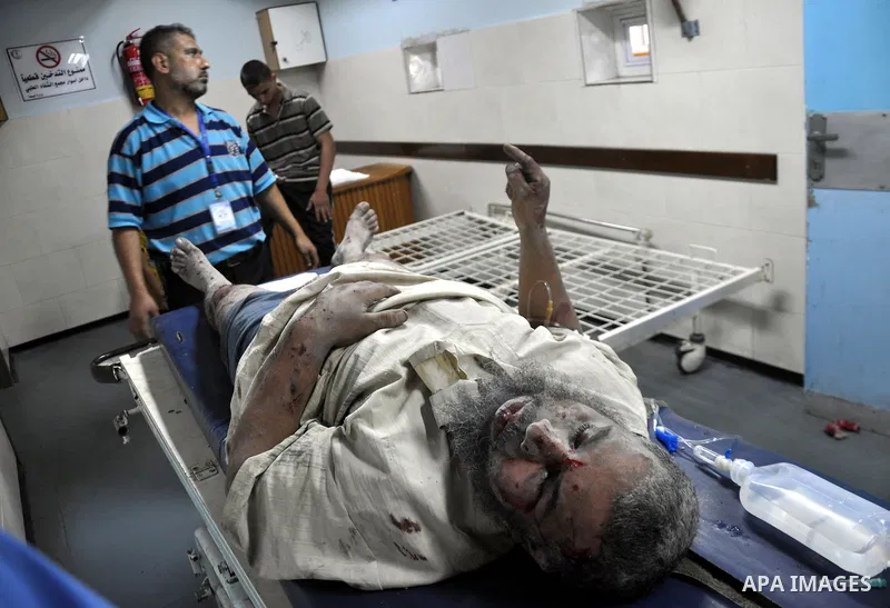 A Palestinian man, wounded in an Israeli air strike on the al-Shati refugee camp, lies on a stretcher as he is treated at the al-Shefa hospital in Gaza City, on August 4, 2014. An eight-year-old girl was killed and 30 pe...