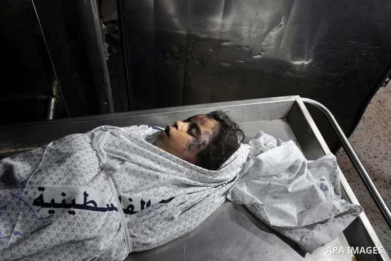 The body of Palestinian girl, Aseel Al-Bakri, 8, whom medics said was killed in an Israeli air strike at Shati (Beach) refugee camp lies at a morgue in Shifa hospital in Gaza City August 4, 2014. A seven-hour truce under...