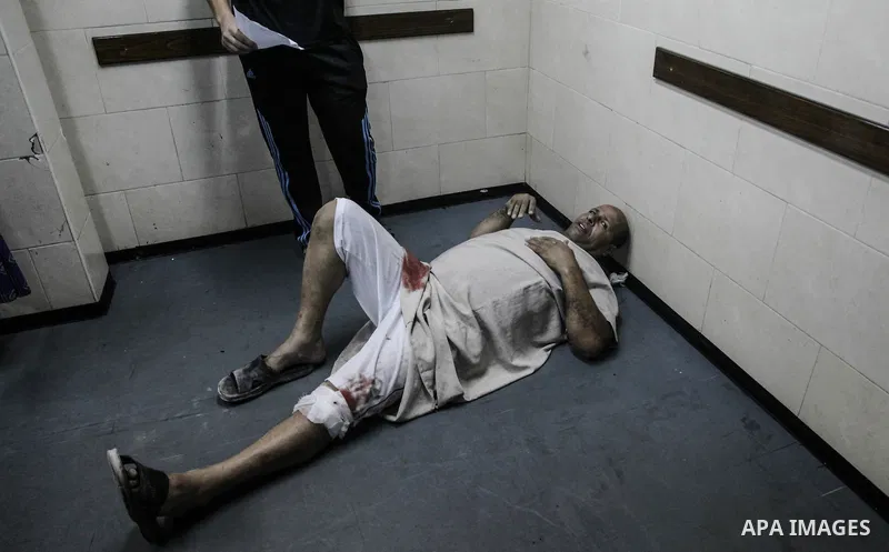 A wounded Palestinian man receives medical treatment in the corridor of the al-Shifa hospital after an Israeli air strike on Gaza City on August 22, 2014. Israeli Prime Minister Benjamin Netanyahu pledged that "Hamas wil...