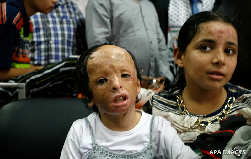 Palestinian childern, who medics said were wounded during the Israeli offensive on Gaza Strip, wait to be given the permission to cross into Egypt at the Rafah border crossing in the southern Gaza Strip, on Sep. 08, 2014...