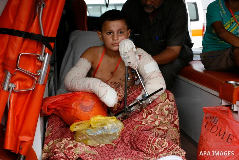 A Palestinian children, who medics said was wounded during the Israeli offensive on Gaza Strip, waits to be given the permission to cross into Egypt at the Rafah border crossing in the southern Gaza Strip, on Sep. 08, 20...