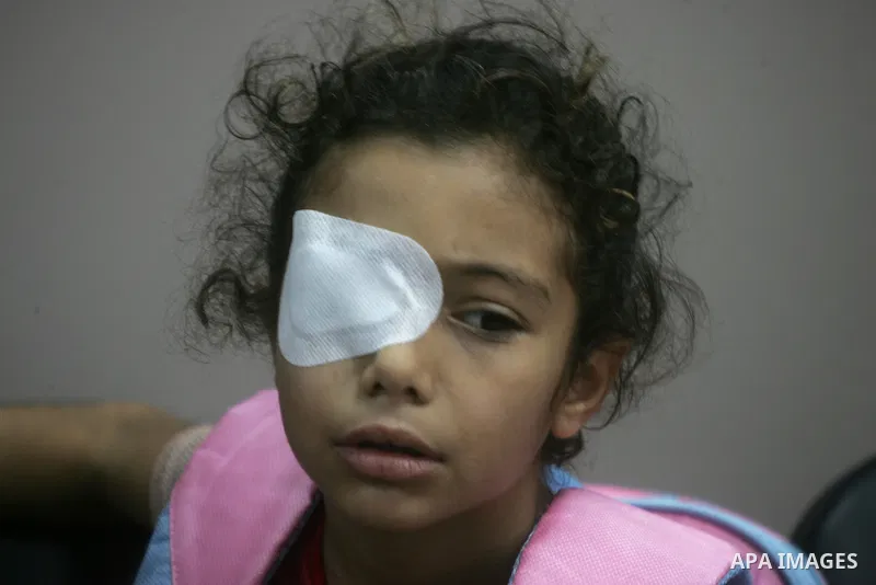 A Palestinian child, who medics said was wounded during the Israeli offensive on Gaza Strip, waits to be given the permission to cross into Egypt at the Rafah border crossing in the southern Gaza Strip, on Sep. 08, 2014....