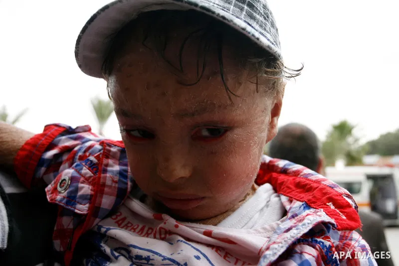 A Palestinian children, who medics said was wounded during the Israeli offensive on Gaza Strip, waits to be given the permission to cross into Egypt at the Rafah border crossing in the southern Gaza Strip, on Sep. 08, 20...