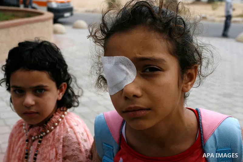 A Palestinian children, who medics said was wounded during the Israeli offensive on Gaza Strip, waits to be given the permission to cross into Egypt at the Rafah border crossing in the southern Gaza Strip, on Sep. 08, 20...