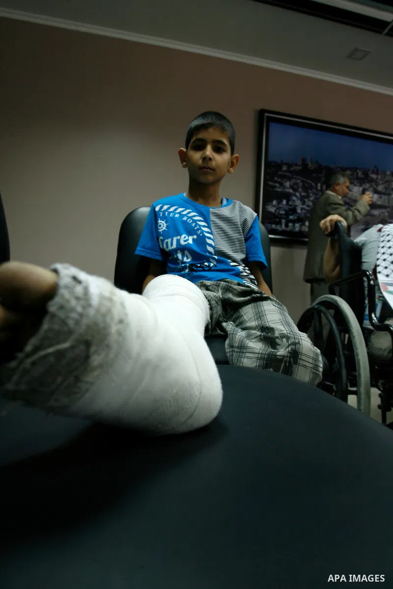 A Palestinian child, who medics said was wounded during the Israeli offensive on Gaza Strip, wait to be given the permission to cross into Egypt at the Rafah border crossing in the southern Gaza Strip, on Sep. 08, 2014....
