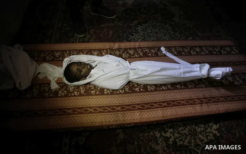 A photo taken on 2 February 2015 shows the body of Jihad Al-Abeed, a 4-year-old Palestinian boy was suffering from quadriplegia, lying on a bed at his family's tin shack, in Gaza city. Al-Abeed died because of not being...