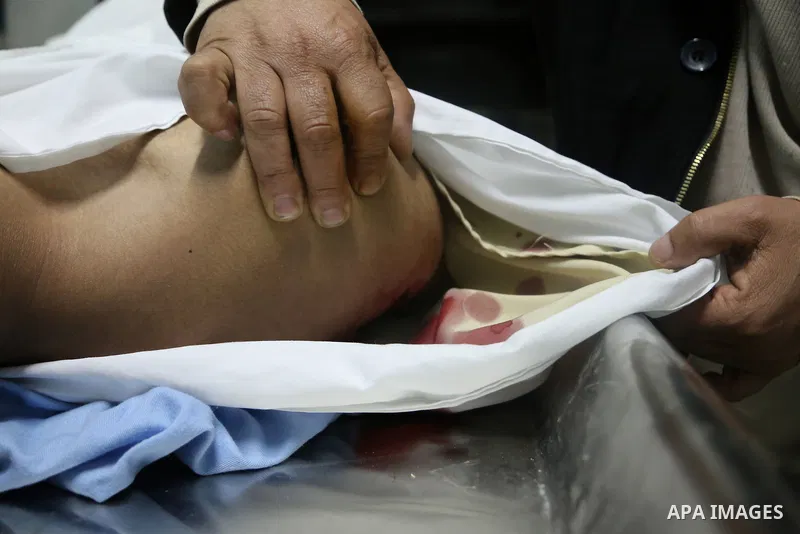 The body of Palestinian Jihad al-Jaafari, 19, who was shot dead by Israeli soldiers, lies in a bed, at a hospital morgue, in the West Bank city of Bethlehem, on February 24, 2015. Israeli soldiers shot dead al-Jaafari, o...