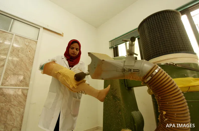 Lana Al-Kronz, 26-year-old Palestinian specialist of prosthetic works on an artificial leg at a center of prosthetic limbs, in Gaza City on April 21, 2015. Al-Krunz is the first Palestinian woman which makes the prosthet...