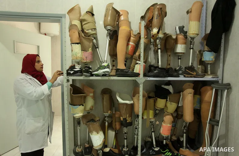 Lana Al-Kronz, 26-year-old Palestinian specialist of prosthetic works on an artificial leg at a center of prosthetic limbs, in Gaza City on April 21, 2015. Al-Krunz is the first Palestinian woman which makes the prosthet...