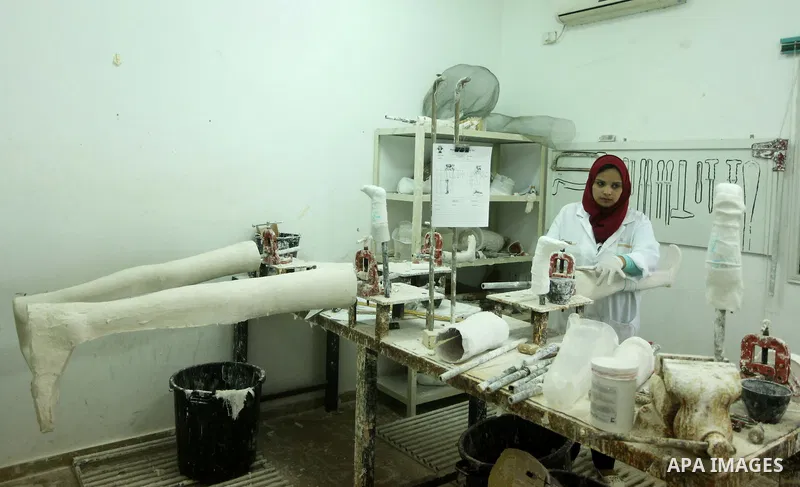 Lana Al-Kronz, 26-year-old Palestinian specialist of prosthetic works on an artificial leg at a center of prosthetic limbs, in Gaza City on April 21, 2015. Al-Krunz is the first Palestinian woman which makes the prosthet...
