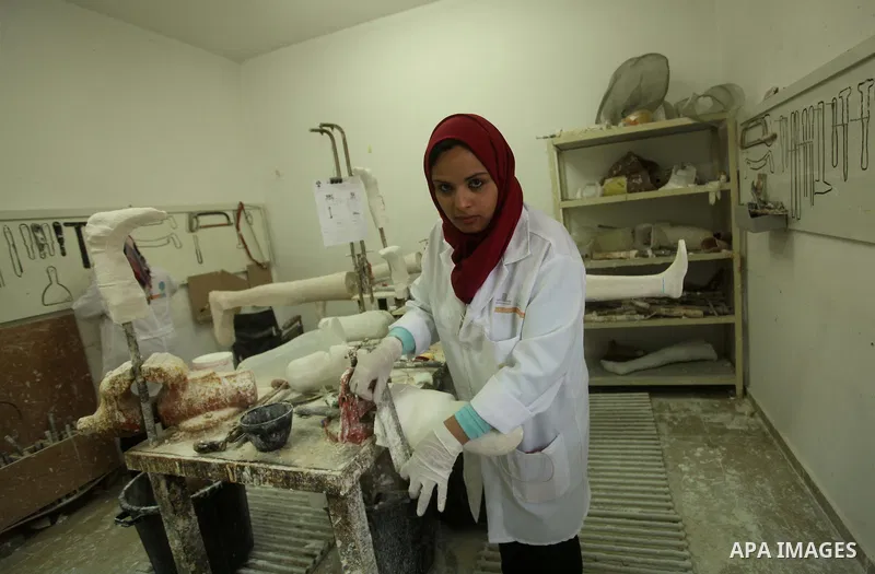 Lana Al-Kronz, 26-year-old Palestinian specialist of prosthetic works on an artificial leg at a center of prosthetic limbs, in Gaza City on April 21, 2015. Al-Krunz is the first Palestinian woman which makes the prosthet...