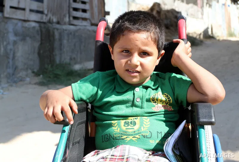 Palestinian boy Ayman Mahmoum, who was injured during the 50-day war between Israel and Hamas militants in the summer of 2014, sits on his wheelchair in a street in Rafah in the southern Gaza Strip on July 29, 2015. Ayma...
