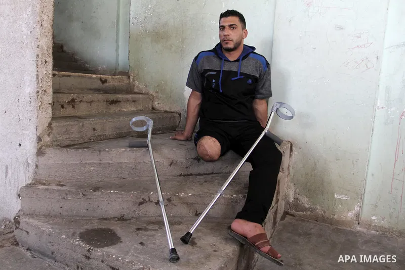 Palestinian Wael al-Namla, who was injured during the 50-day war between Israel and Hamas militants in the summer of 2014, sits on the stairs at his house on July 30, 2015 in Rafah in the southern Gaza Strip. Wael al-Nam...