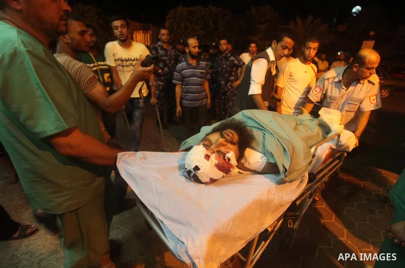 A wounded Palestinian is brought into a hospital following what witnesses said was an Israeli air strike in the central Gaza Strip August 7, 2015. An Israeli plane attacked an armed training camp of the Islamist Hamas gr...