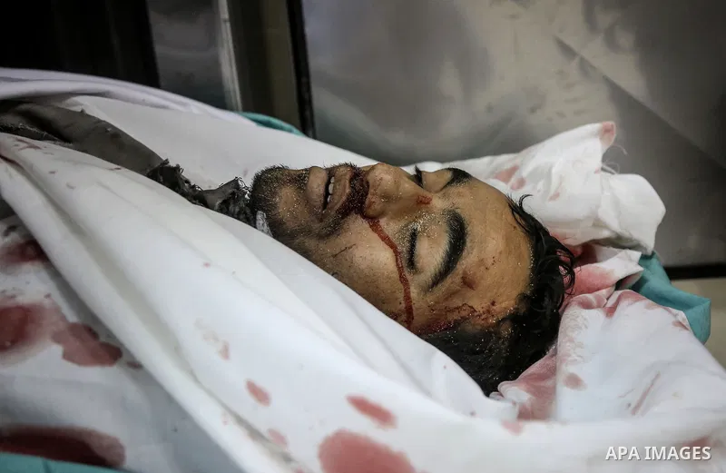 The body of Palestinian Moses Zuaiter, 31, lies on the bed at a hospital morgue, in Beit Lahia in the northern Gaza Strip on January 13, 2016. A Palestinian was killed and three others were injured by Israeli artillery f...