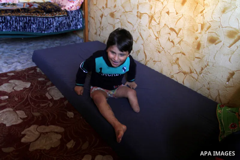 Palestinian child Sharif al-Namla who was injured during the 50-day war between Israel and Hamas militants in the summer of 2014, sits at his house on Feb. 28, 2016 in Rafah in the southern Gaza Strip. Wael al-Namla, 27,...