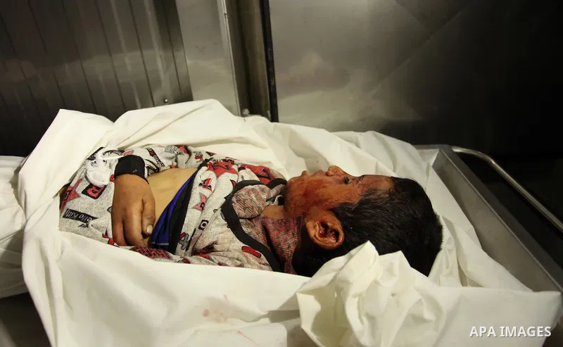 The body of Palestinian Yasin Abu Khussa, 10, lies on the bed in the morgue of a hospital following an Israeli air strike in the northern Gaza strip on March 12, 2016. Israeli planes struck Hamas bases in the Gaza Strip...