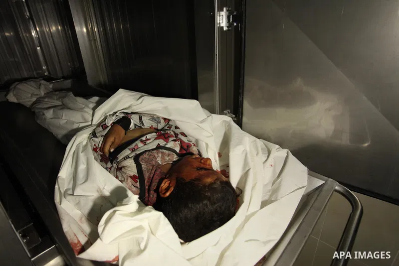 The body of Palestinian Yasin Abu Khussa, 10, lies on the bed in the morgue of a hospital following an Israeli air strike in the northern Gaza strip on March 12, 2016. Israeli planes struck Hamas bases in the Gaza Strip...