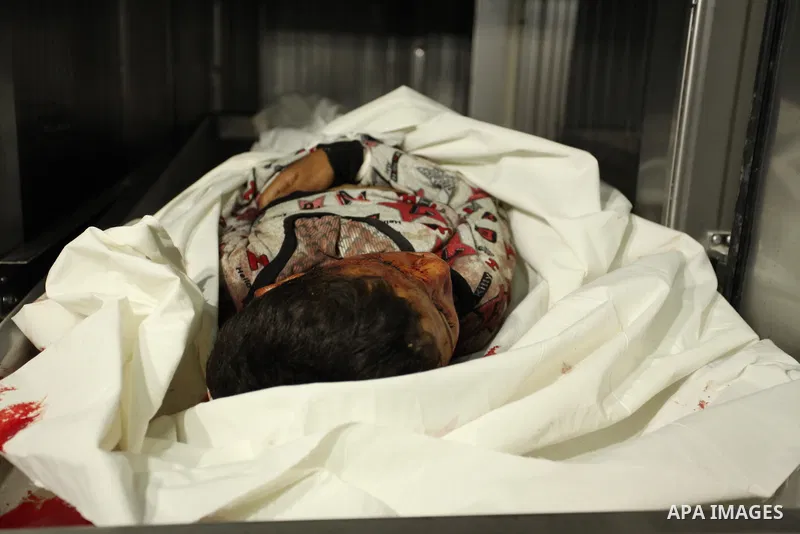 The body of Palestinian Yasin Abu Khussa, 10, lies on the bed in the morgue of a hospital following an Israeli air strike in the northern Gaza strip on March 12, 2016. Israeli planes struck Hamas bases in the Gaza Strip...