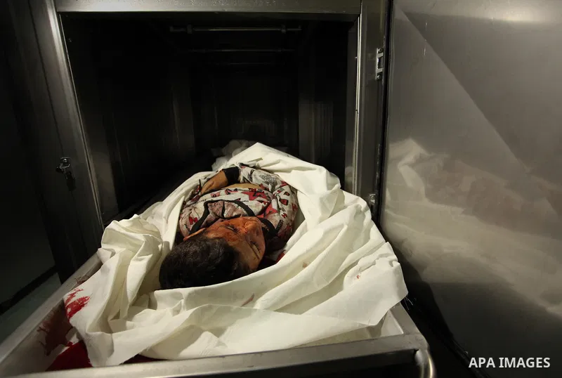 The body of Palestinian Yasin Abu Khussa, 10, lies on the bed in the morgue of a hospital following an Israeli air strike in the northern Gaza strip on March 12, 2016. Israeli planes struck Hamas bases in the Gaza Strip...