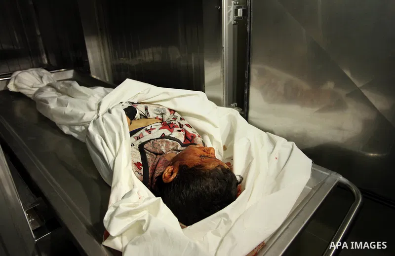 The body of Palestinian Yasin Abu Khussa, 10, lies on the bed in the morgue of a hospital following an Israeli air strike in the northern Gaza strip on March 12, 2016. Israeli planes struck Hamas bases in the Gaza Strip...