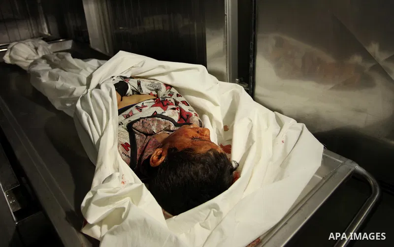 The body of Palestinian Yasin Abu Khussa, 10, lies on the bed in the morgue of a hospital following an Israeli air strike in the northern Gaza strip on March 12, 2016. Israeli planes struck Hamas bases in the Gaza Strip...