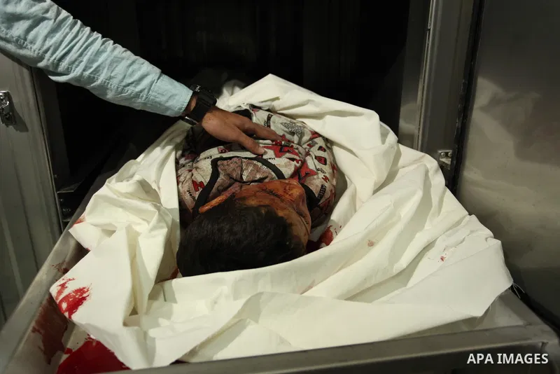 The body of Palestinian Yasin Abu Khussa, 10, lies on the bed in the morgue of a hospital following an Israeli air strike in the northern Gaza strip on March 12, 2016. Israeli planes struck Hamas bases in the Gaza Strip...