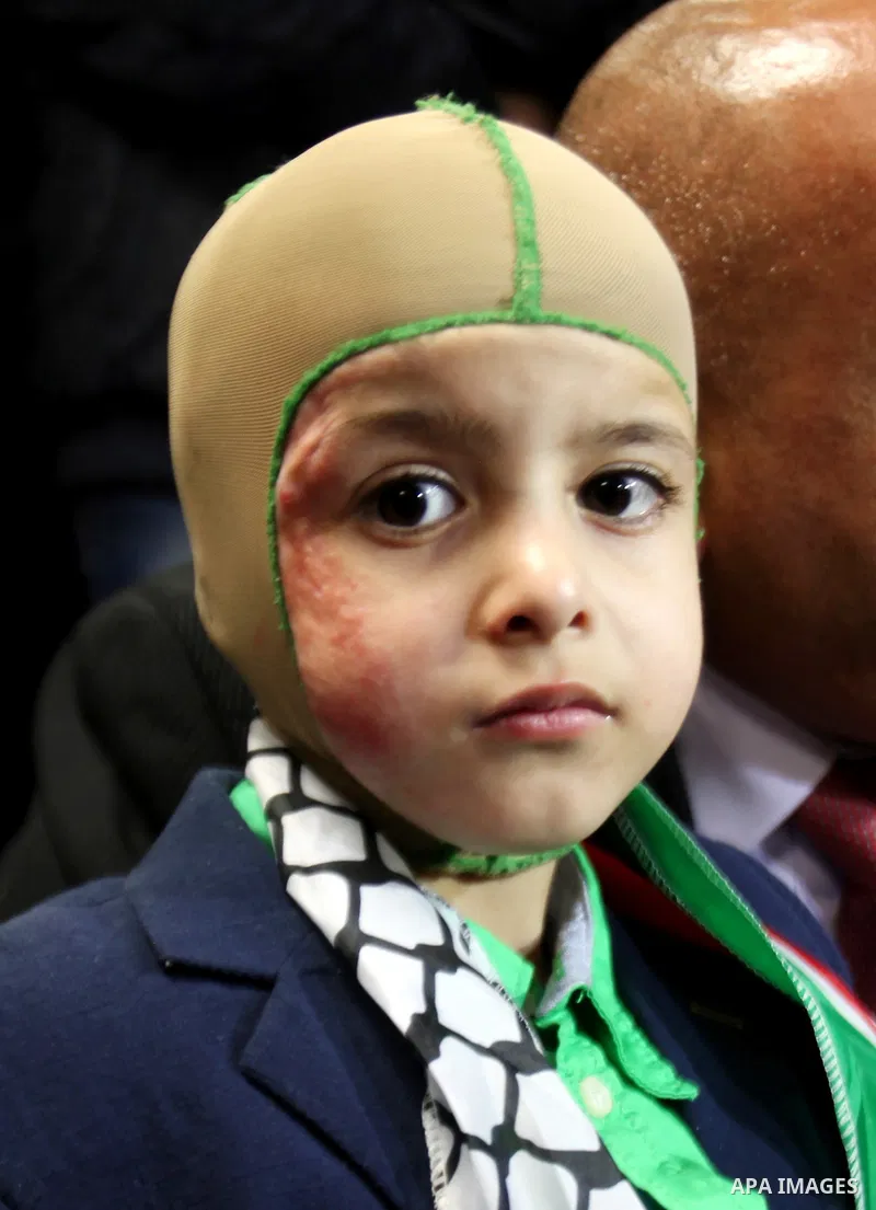 Five-year-old Ahmed Dawabsha, a Palestinian boy who survived a firebombing by Jewish extremists targeting his family home that killed his parents and brother, meets with the governor of the northern Palestinian town of N...