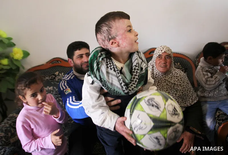 Palestinian boy Ahmed Dawabsha, 5, who suffered severe burns in an arson attack by suspected Jewish attackers on his family home last July and in which his younger brother, Ali, and his parents both died, is welcomed by...