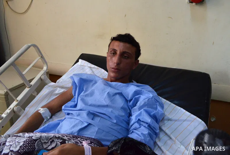 A rescued migrant lies in bed as he receives treatment at Rashid hospital in the port city of Rosetta, north of Cairo, Egypt, September 22, 2016. Egypt's official news agency MENA said the boat was carrying 600 people wh...